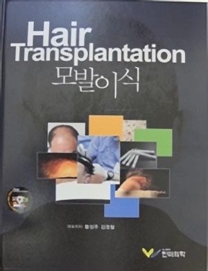 Hair Transplantation Korean Edition